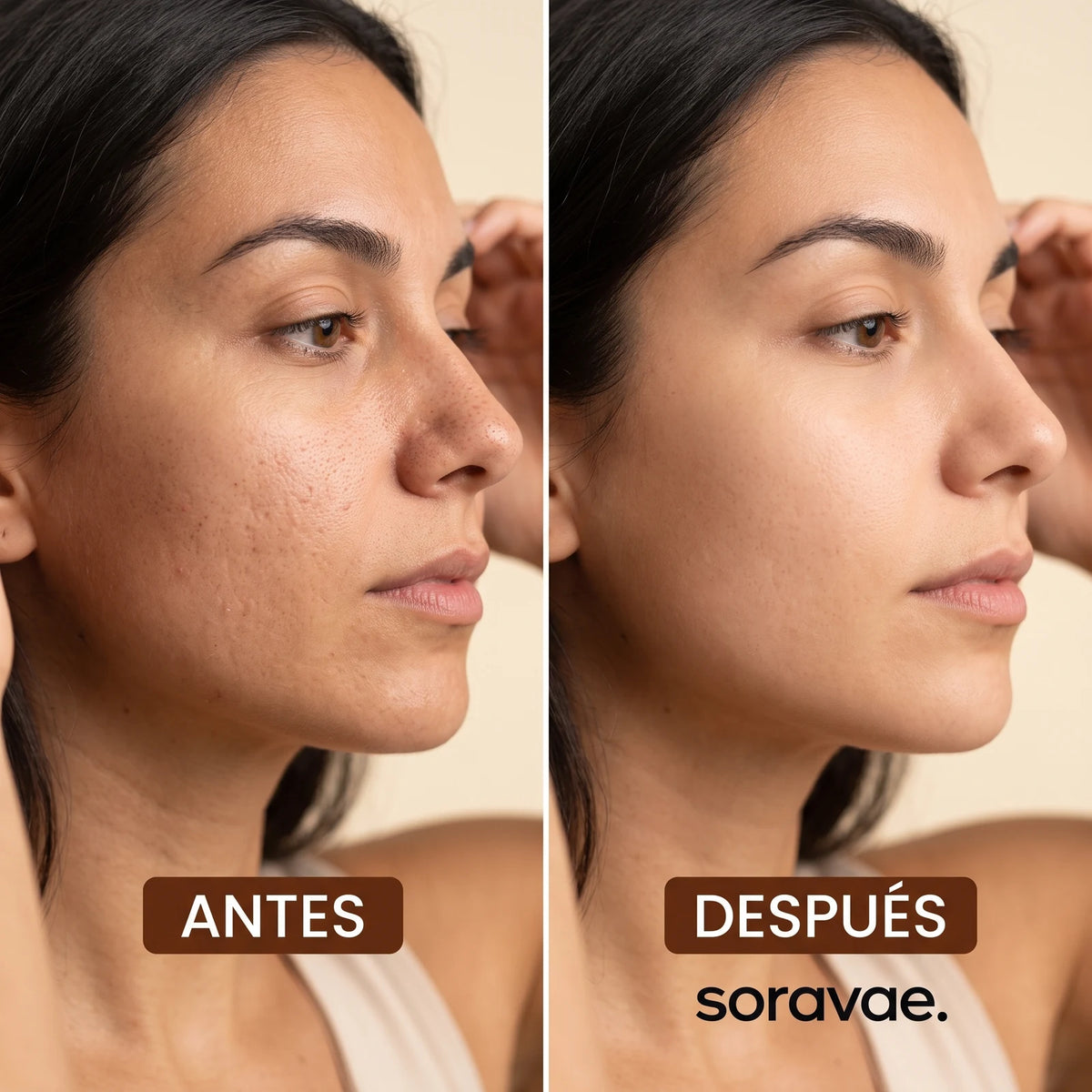 Dispositivo electrónico de succión para limpieza facial profunda — 2
