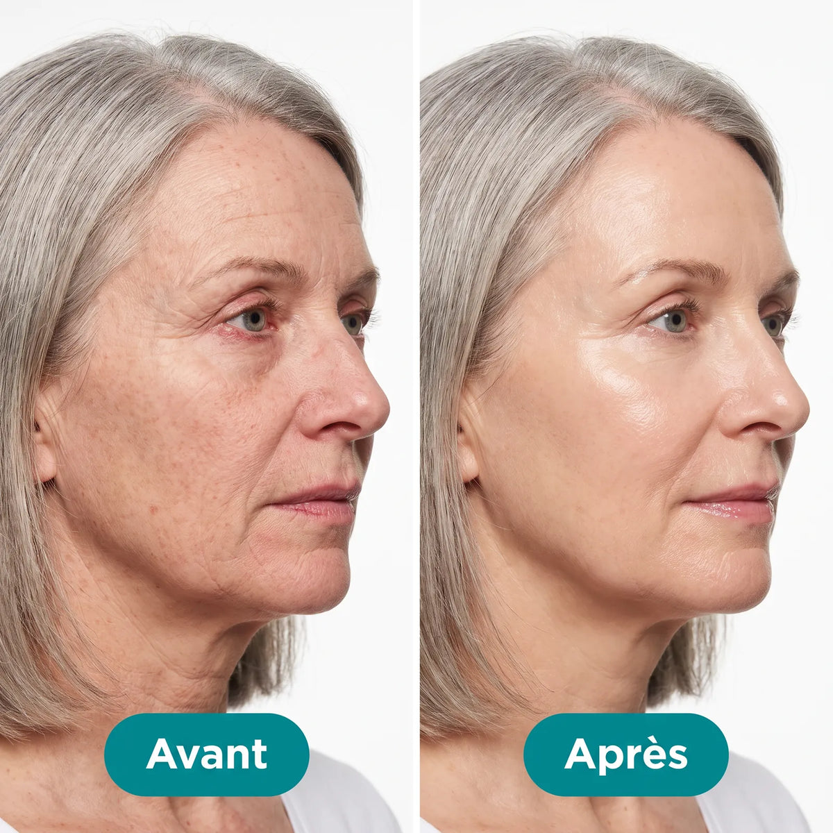 Sérum Hydratant Intensif à l'Acide Hyaluronique — 8