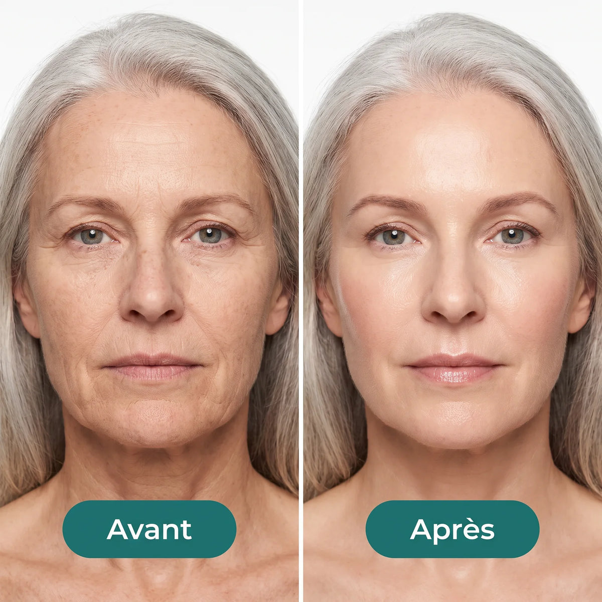 Sérum Hydratant Visage à l'Acide Hyaluronique — 8