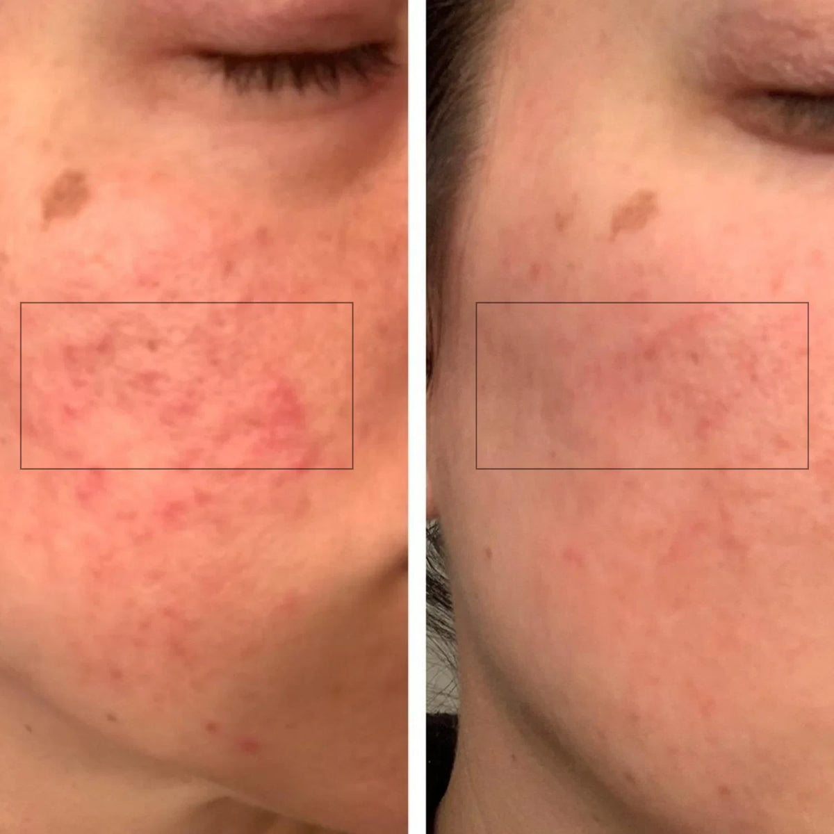 Ember Tallow and Honey Moisturizing Balm, Sensitive epidermis lacking hydration