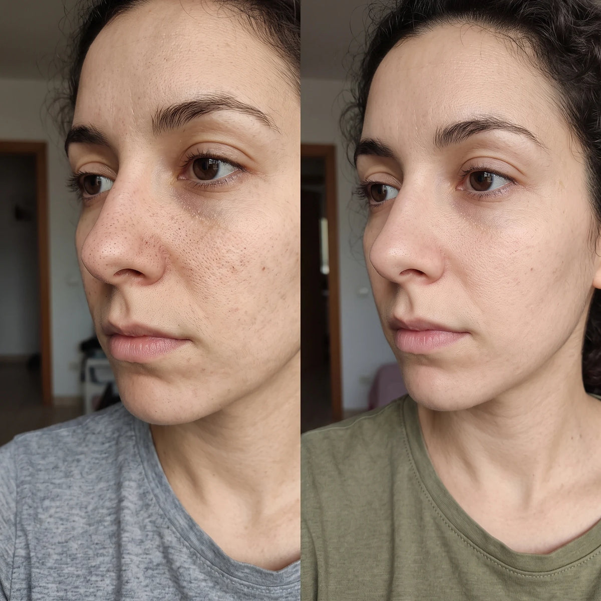 Dispositivo electrónico de succión para limpieza facial profunda, beneficios
