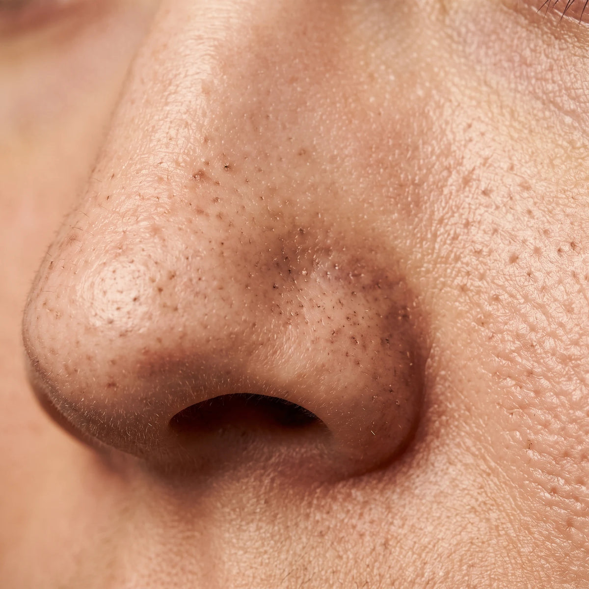 Dispositivo electrónico de succión para limpieza facial profunda, causa raíz