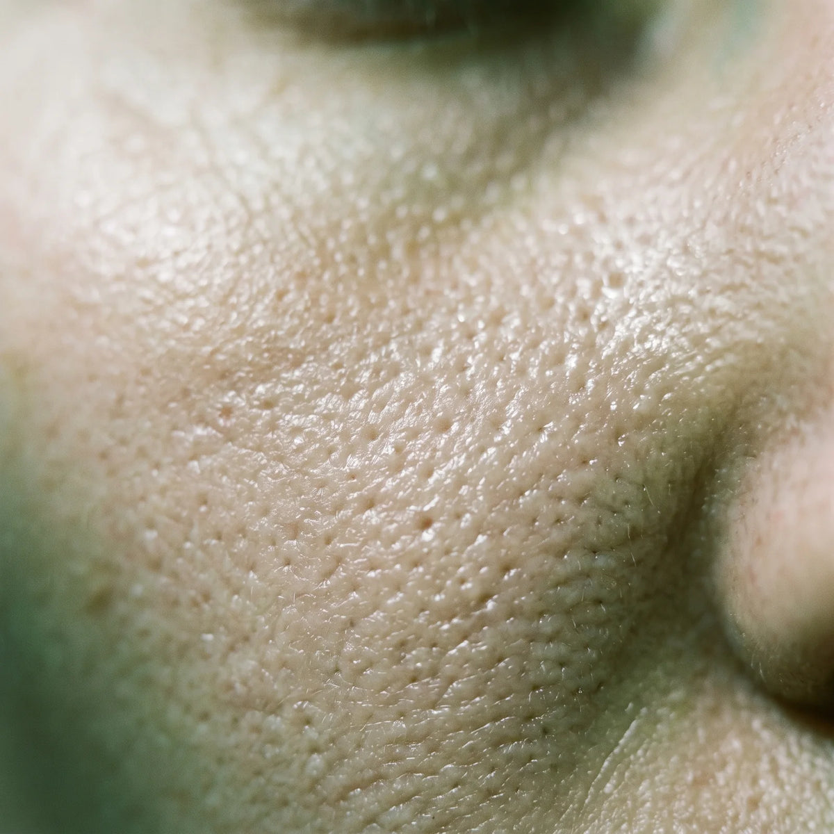 Barra Purificante Facial de Arcilla y Té Verde, causa raíz