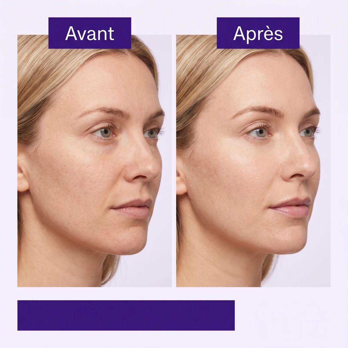 Sérum Rétinol Anti-Âge Lissant — 3