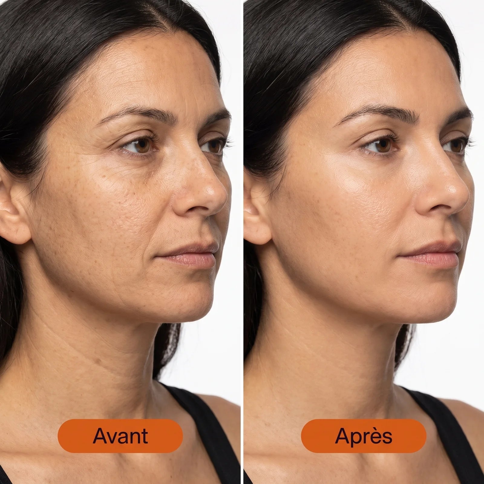 Sérum Éclaircissant Anti-oxydant à la Vitamine C — 2