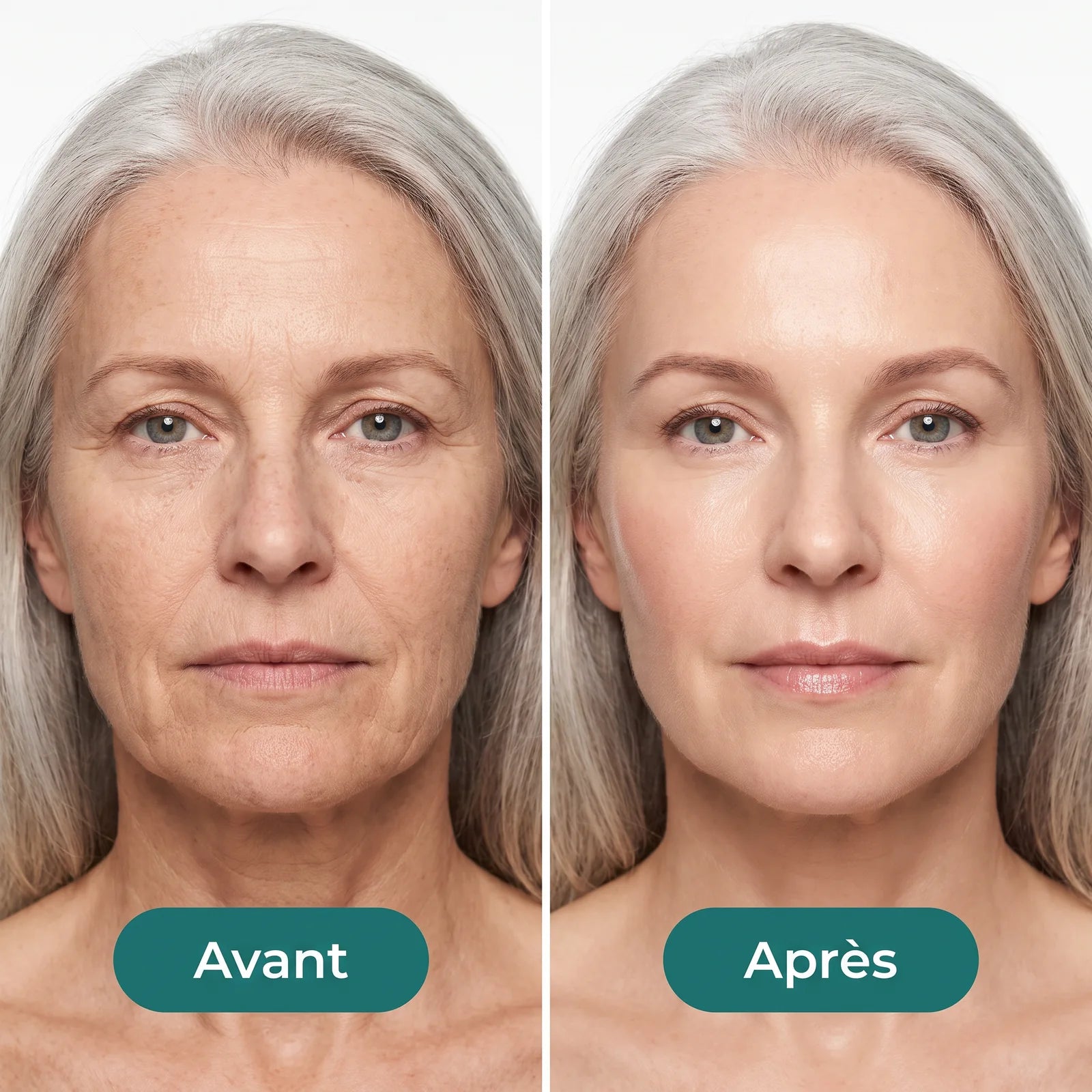 Sérum Hydratant Visage à l'Acide Hyaluronique — 8