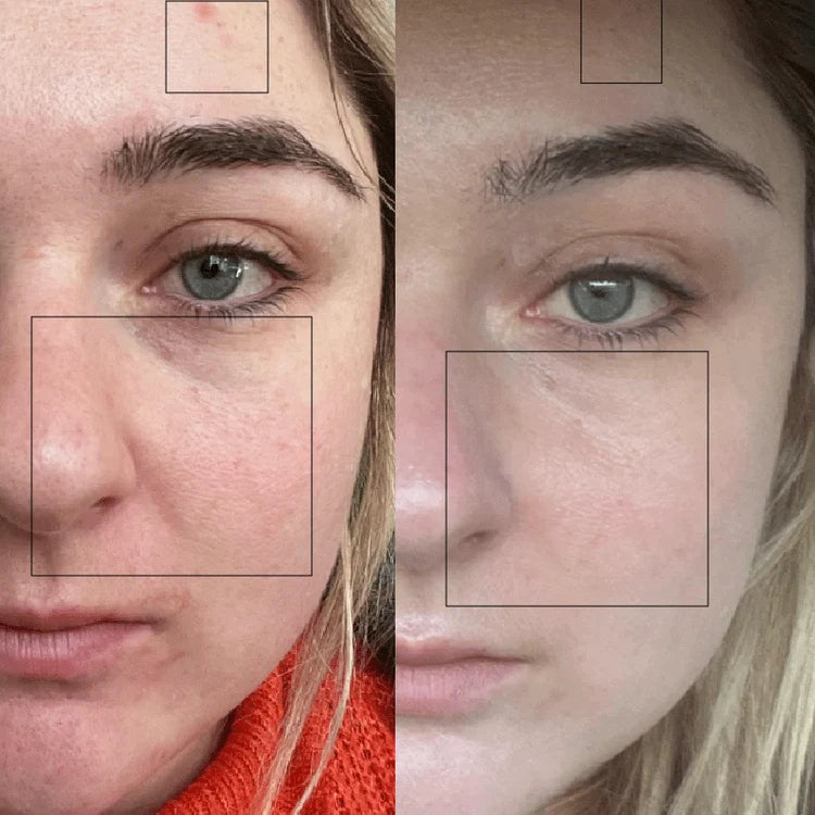 Soravae | Masque Purifiant au Thé Vert en Stick